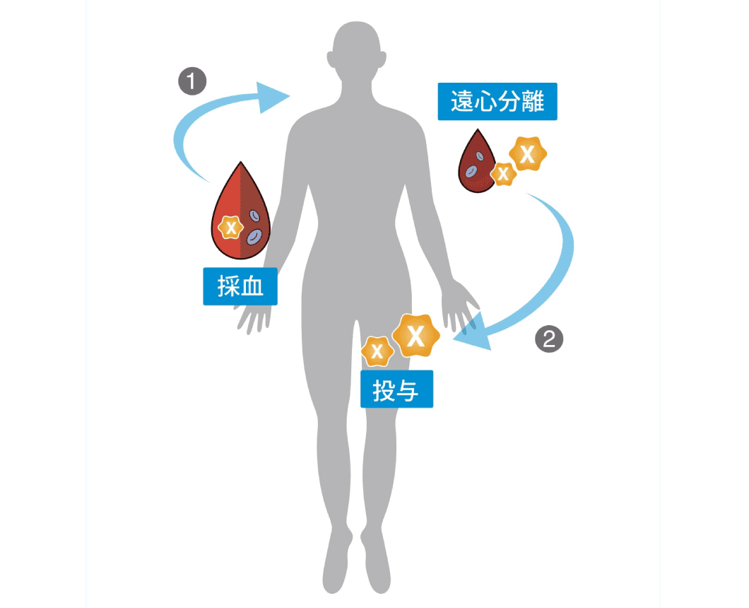 手指への再生医療