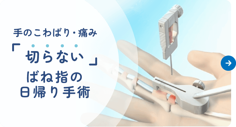 手のこわばり・痛み｜『切らない』ばね指の日帰り手術