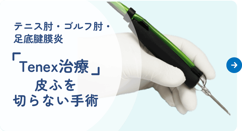 テニス肘・ゴルフ肘・足底腱膜炎『Tenex治療』　皮ふを切らない手術