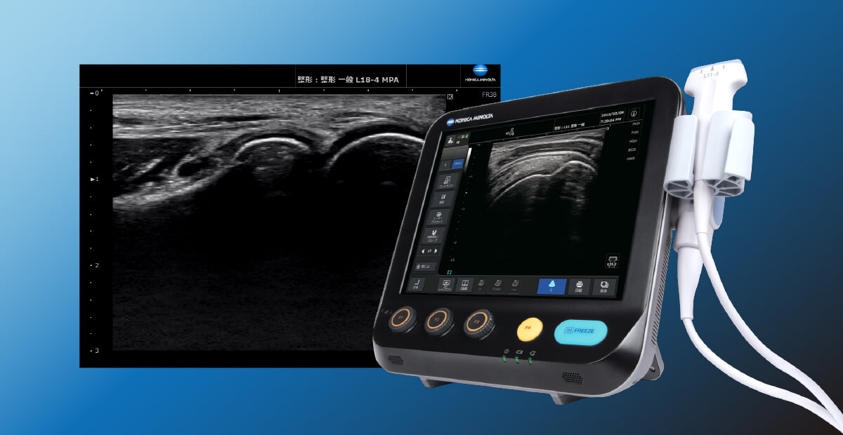 超音波エコーを活用した先進の治療