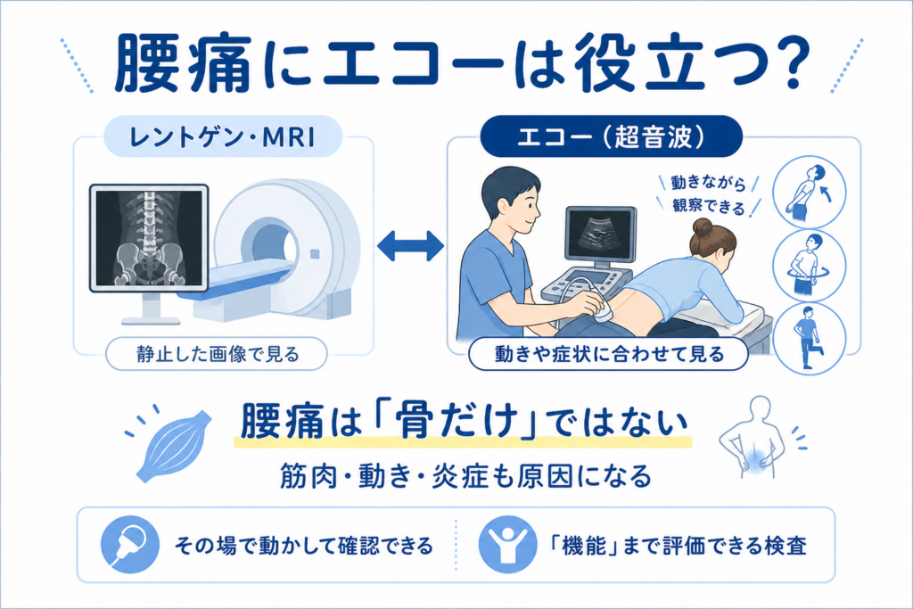 腰痛の原因はレントゲンだけではわからない？ エコーで見える腰痛診療